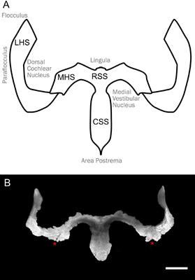 3D Reconstruction of the Clarified Rat Hindbrain Choroid Plexus